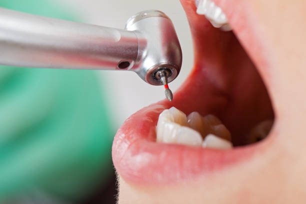 Best Knocked-Out Tooth Emergency  in Soddy Daisy, TN